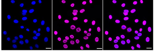 SFPQ Antibody in Immunocytochemistry (ICC/IF)
