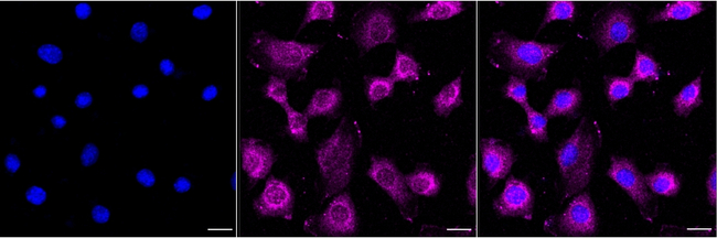 SLC25A12 Antibody in Immunocytochemistry (ICC/IF)