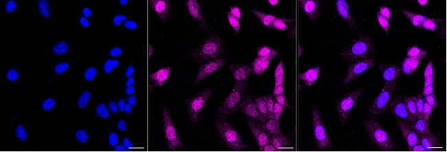 SMAD1 Antibody in Immunocytochemistry (ICC/IF)