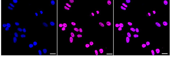 BRG1 Antibody in Immunocytochemistry (ICC/IF)