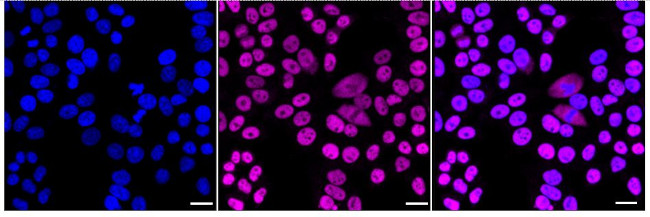 SMC3 Antibody in Immunocytochemistry (ICC/IF)