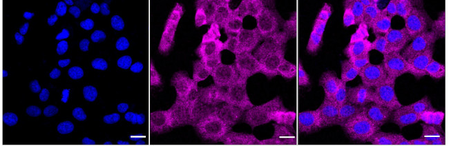 SMC4 Antibody in Immunocytochemistry (ICC/IF)