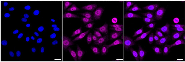 SMCHD1 Antibody in Immunocytochemistry (ICC/IF)