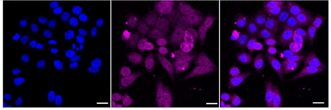 SMYD3 Antibody in Immunocytochemistry (ICC/IF)