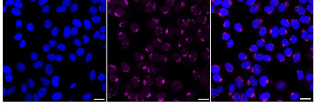 SSTR5 Antibody in Immunocytochemistry (ICC/IF)
