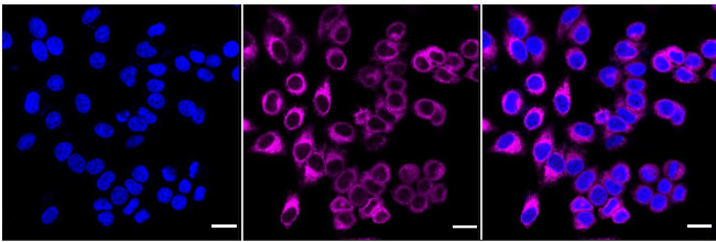 SHH Antibody in Immunocytochemistry (ICC/IF)