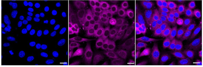 SNX1 Antibody in Immunocytochemistry (ICC/IF)