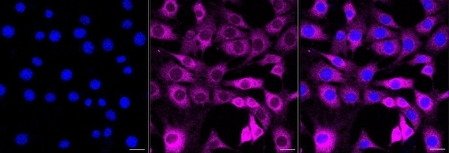 SNX4 Antibody in Immunocytochemistry (ICC/IF)