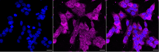 SNX5 Antibody in Immunocytochemistry (ICC/IF)