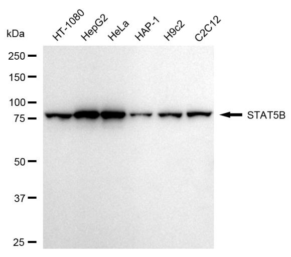 STAT5 beta Antibody in Western Blot (WB)