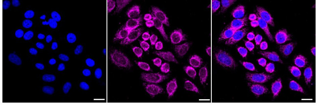 STOML2 Antibody in Immunocytochemistry (ICC/IF)