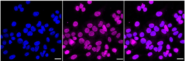 UNC84A Antibody in Immunocytochemistry (ICC/IF)
