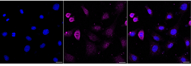SOD2 Antibody in Immunocytochemistry (ICC/IF)