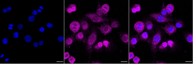 SNAP25 Antibody in Immunocytochemistry (ICC/IF)