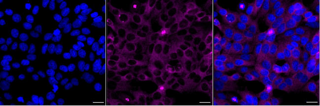 TACC3 Antibody in Immunocytochemistry (ICC/IF)