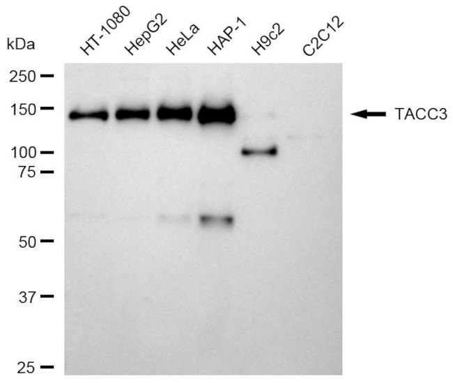 TACC3 Antibody in Western Blot (WB)