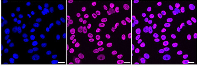 TAF15 Antibody in Immunocytochemistry (ICC/IF)
