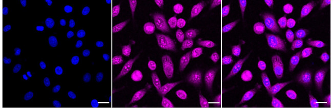 TBK1 Antibody in Immunocytochemistry (ICC/IF)