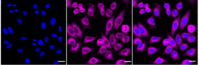 TBK1 Antibody in Immunocytochemistry (ICC/IF)