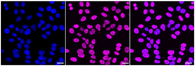 TRBP Antibody in Immunocytochemistry (ICC/IF)