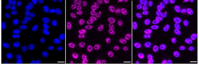 AP2 alpha Antibody in Immunocytochemistry (ICC/IF)