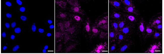TFE3 Antibody in Immunocytochemistry (ICC/IF)