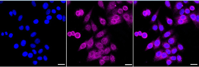 TREX1 Antibody in Immunocytochemistry (ICC/IF)