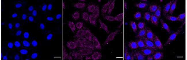 TIMM50 Antibody in Immunocytochemistry (ICC/IF)