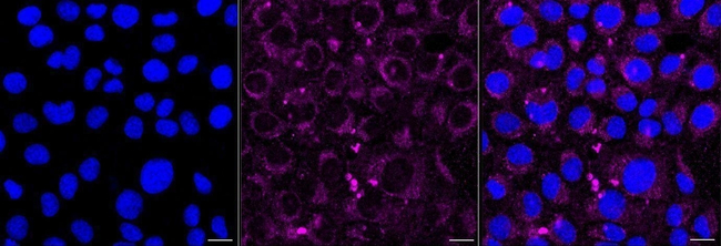 CD266 Antibody in Immunocytochemistry (ICC/IF)