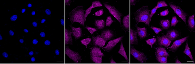 TOE1 Antibody in Immunocytochemistry (ICC/IF)