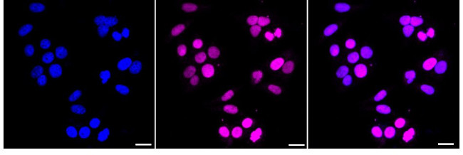 TOP2A Antibody in Immunocytochemistry (ICC/IF)
