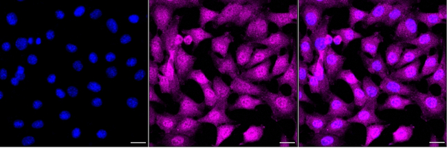 DP1 Antibody in Immunocytochemistry (ICC/IF)
