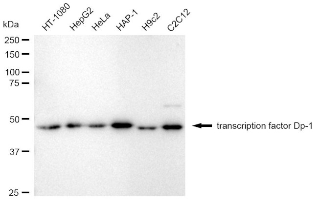 DP1 Antibody in Western Blot (WB)