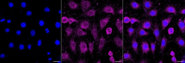 TMEM43 Antibody in Immunocytochemistry (ICC/IF)