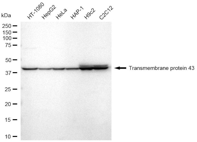TMEM43 Antibody in Western Blot (WB)