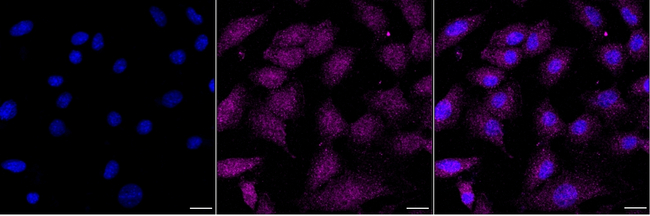 TPP2 Antibody in Immunocytochemistry (ICC/IF)
