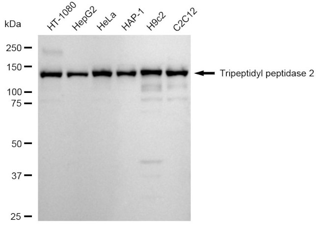 TPP2 Antibody in Western Blot (WB)