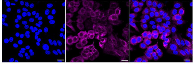 TRK fused gene Antibody in Immunocytochemistry (ICC/IF)