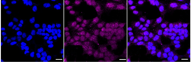 5T4 Antibody in Immunocytochemistry (ICC/IF)