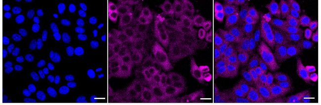 TRPM7 Antibody in Immunocytochemistry (ICC/IF)