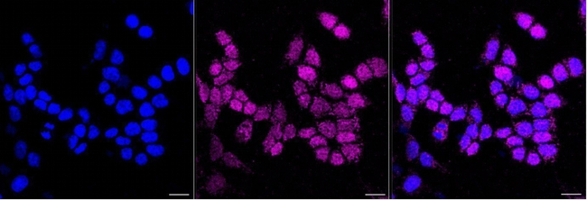 p73 Antibody in Immunocytochemistry (ICC/IF)