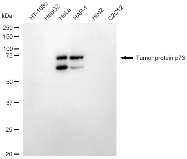 p73 Antibody in Western Blot (WB)