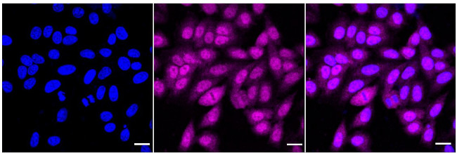 UBE2L3 Antibody in Immunocytochemistry (ICC/IF)