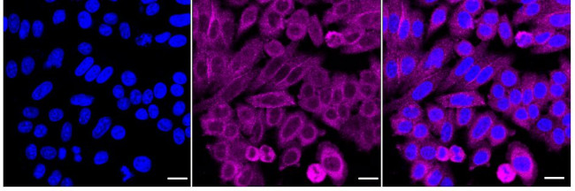 USP14 Antibody in Immunocytochemistry (ICC/IF)