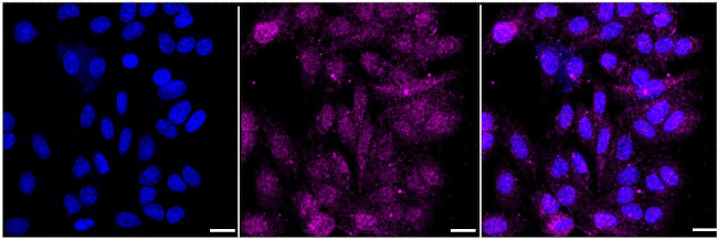 USP5 Antibody in Immunocytochemistry (ICC/IF)