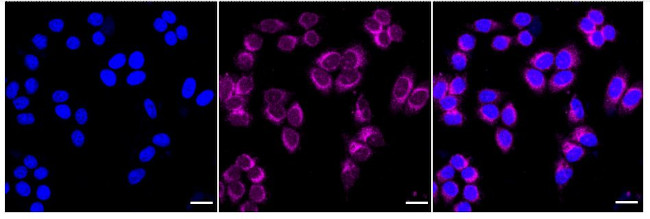 UBE4A Antibody in Immunocytochemistry (ICC/IF)