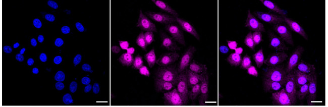 UBE4B Antibody in Immunocytochemistry (ICC/IF)