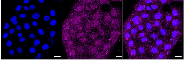 HYD Antibody in Immunocytochemistry (ICC/IF)