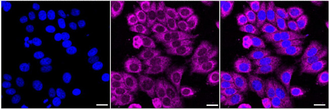UQCRFS1 Antibody in Immunocytochemistry (ICC/IF)