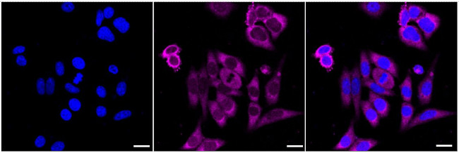 UNG Antibody in Immunocytochemistry (ICC/IF)